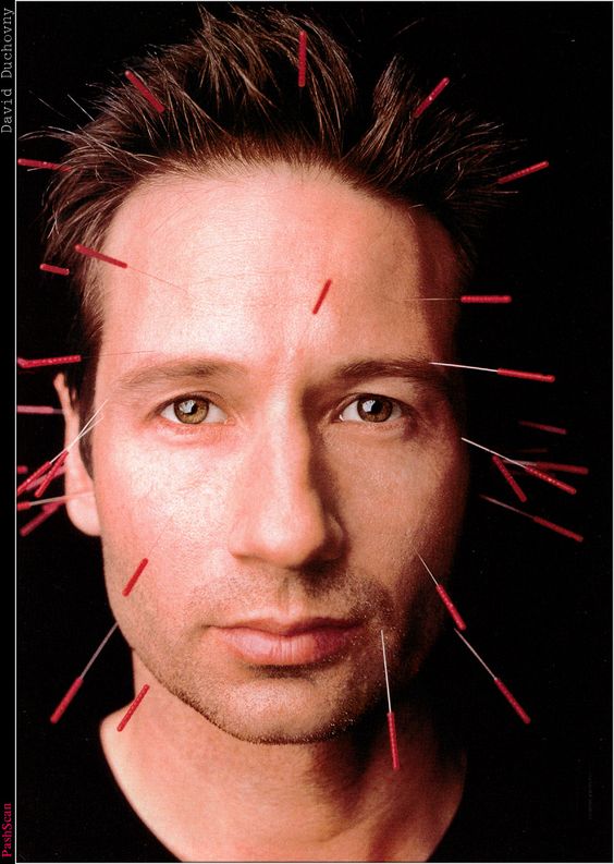 aesthetic acupuncture