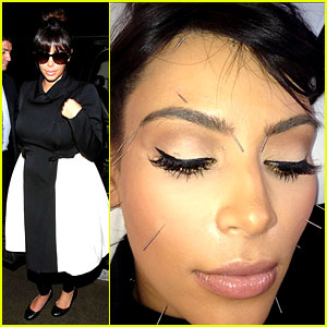 acupuntura estética