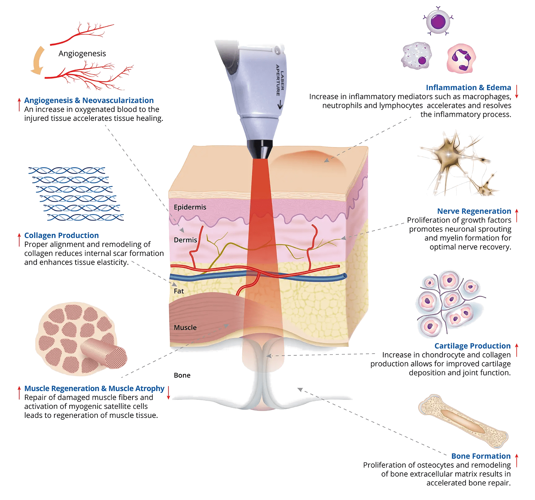 Mecanismos de la acupuntura láser sistema Bioflex láser